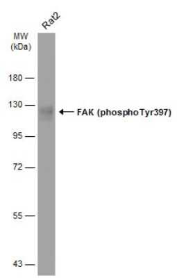 Western Blot: FAK [p Tyr397] Antibody [NBP3-12897]